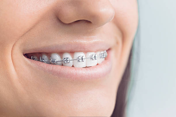 Best Dental Inlays and Onlays  in Morristown, IN